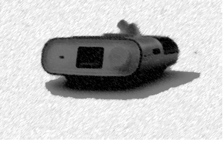 Philips se niega a retirar de hospitales 5000 respiradores que causan enfermedades y muerte